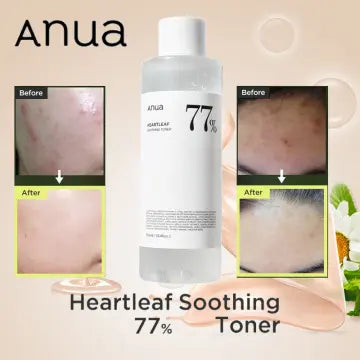 Anua Heartleaf 77% Soothing Toner I pH 5.5 Trouble Care, Calming Skin,  Refreshing, Hydrating, Purifying, Cruelty Free, Vegan,(250ml / 8.45 fl.oz.)