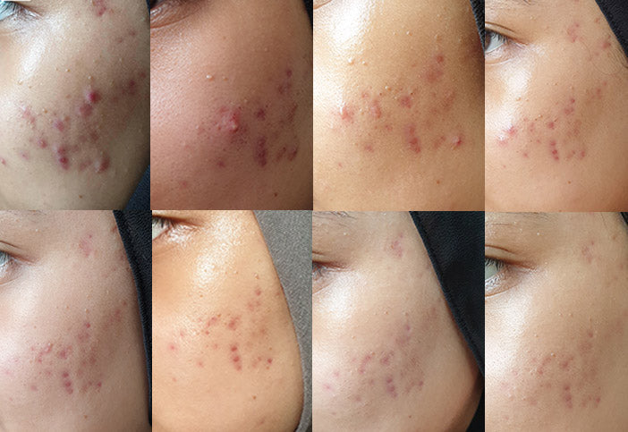 액시스와이 비건 아티초크 인텐시브 스킨 베리어 앰플 30ML