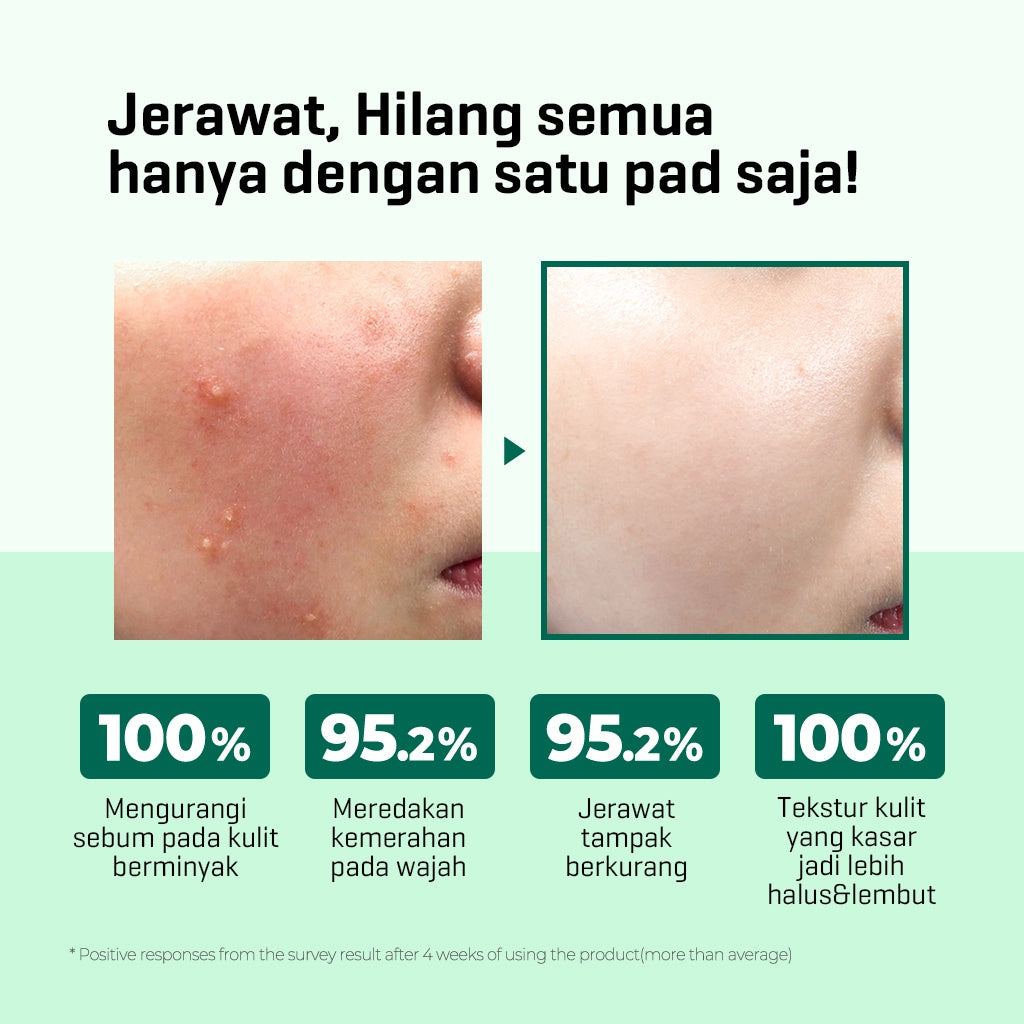 SOME BY MI AHA BHA PHA 30 DAYS MIRACLE TRUECICA CLEAR PAD (70ea)
