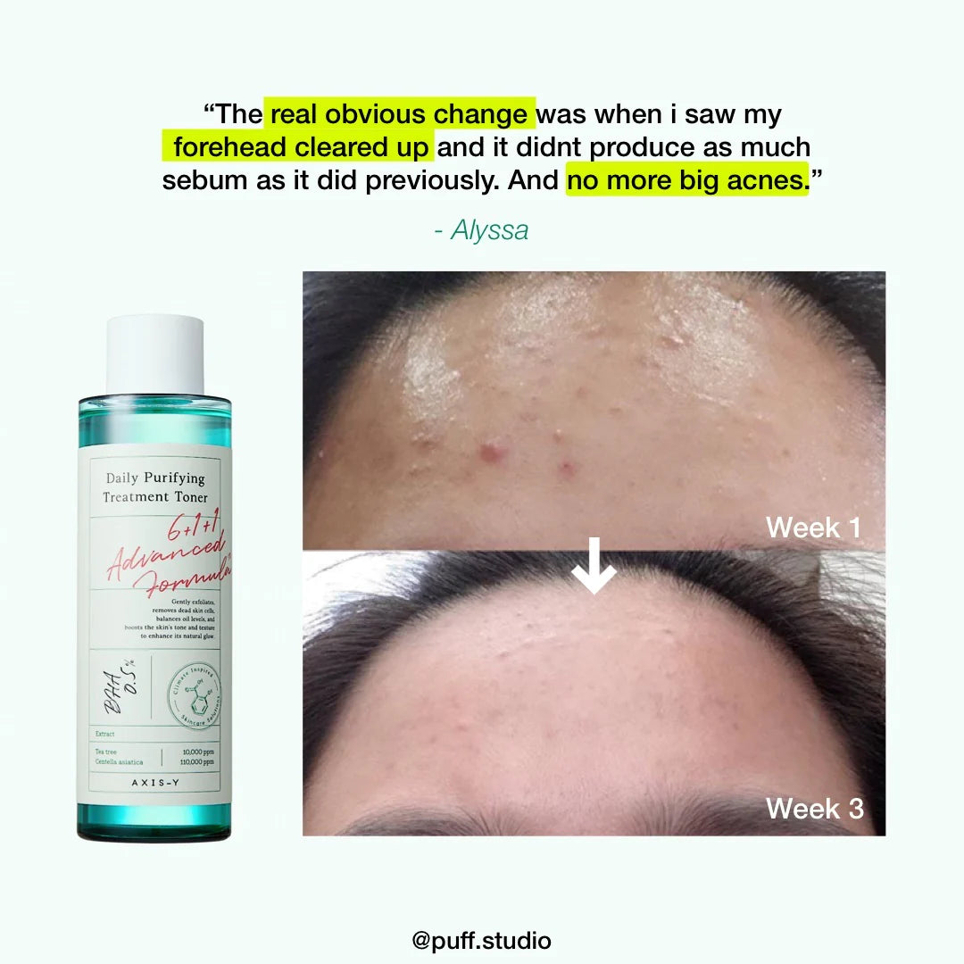 Axis-Y Daily Purifying Treatment Toner - 200ml BHA SOOTHING