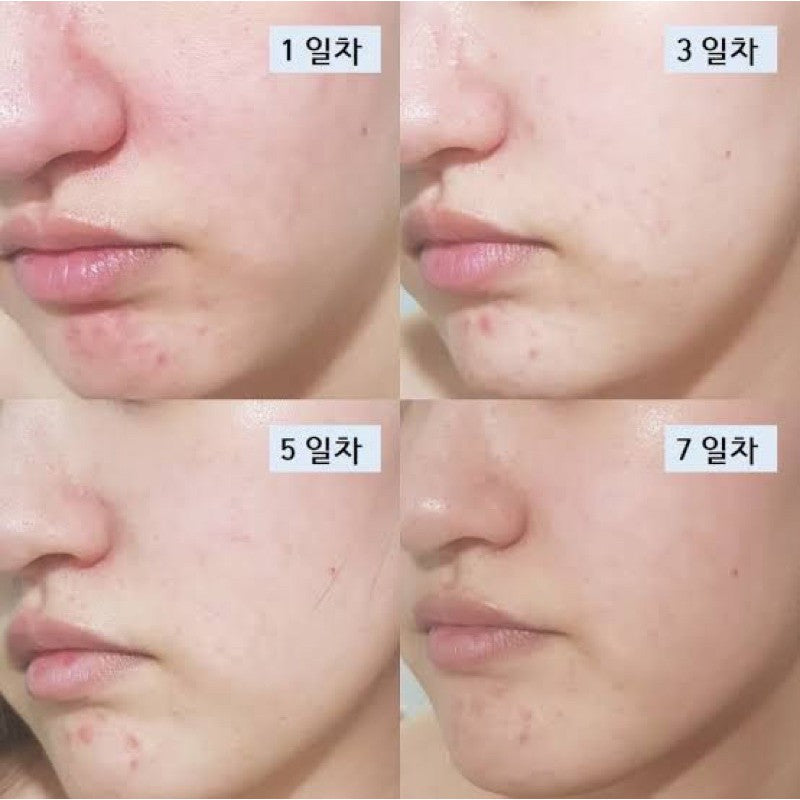 닥터지 레드 블레미쉬 클리어 수딩 토너 200ML