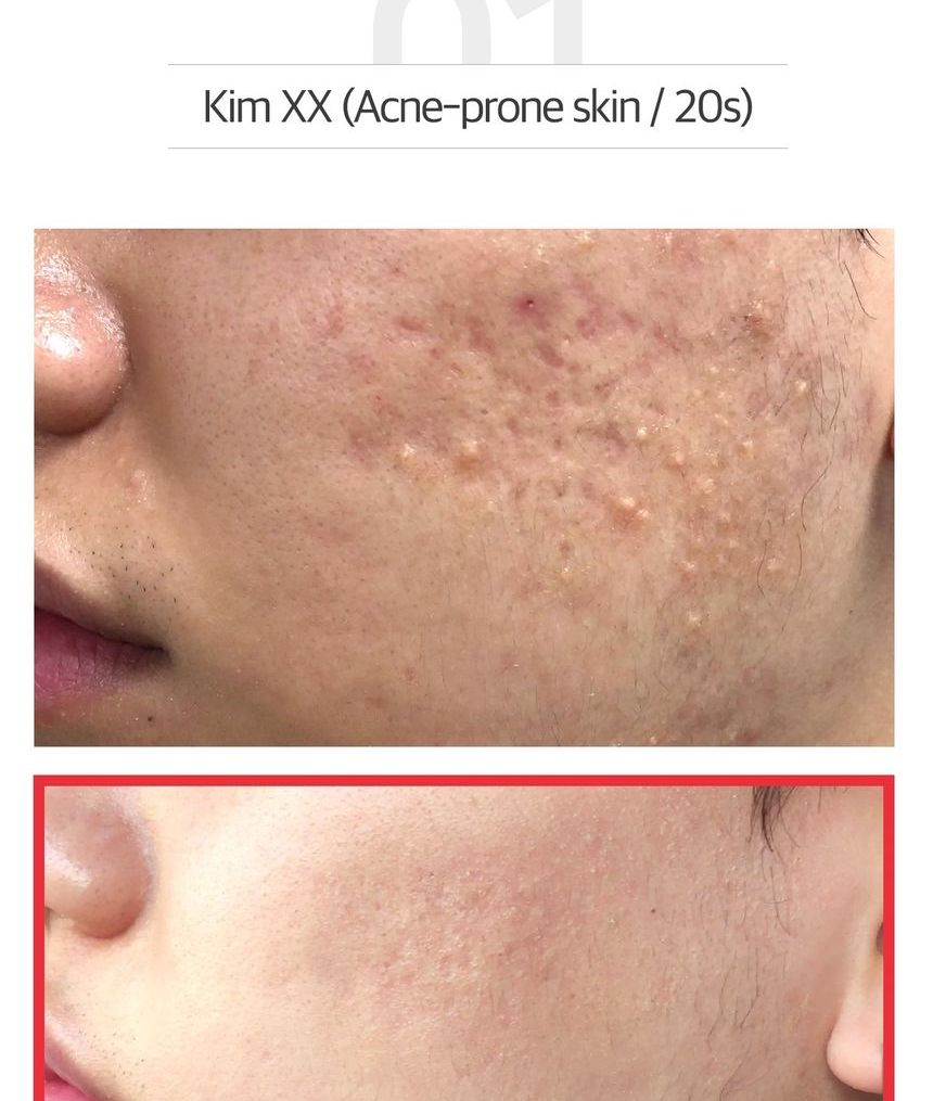 썸바이미 스네일 트루시카 미라클 리페어 로우 ph 젤 클렌저 100ml