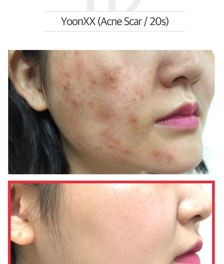 썸바이미 스네일 트루시카 미라클 리페어 로우 ph 젤 클렌저 100ml