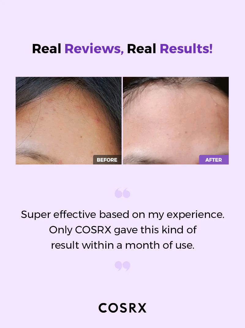 COSRX AHA/BHA 클래리파잉 트리트먼트 토너 150ml; 각질제거, 수분공급, 피부결 정리