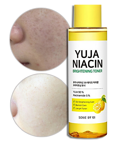 Some By Mi Yuja Niacin, 브라이트닝 토너, 150ml(5.07fl oz)