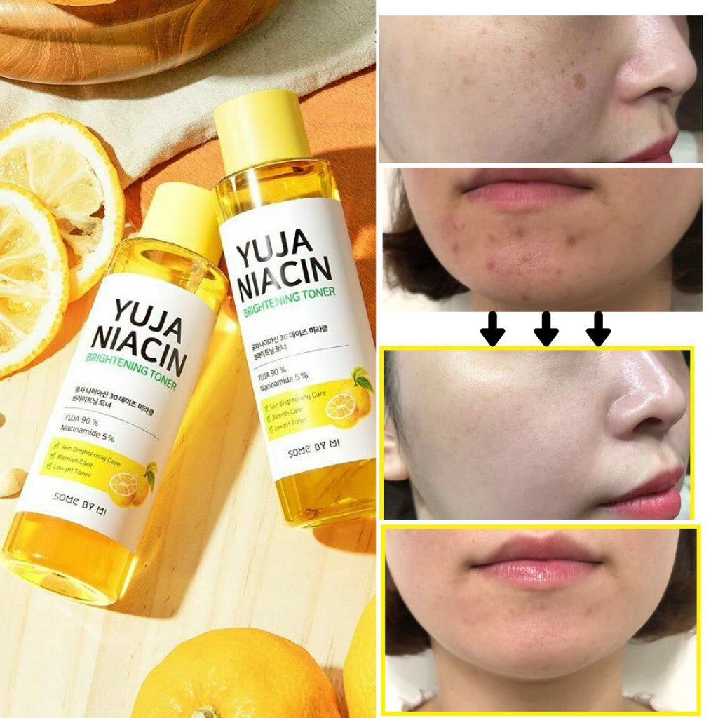 Some By Mi Yuja Niacin, 브라이트닝 토너, 150ml(5.07fl oz)