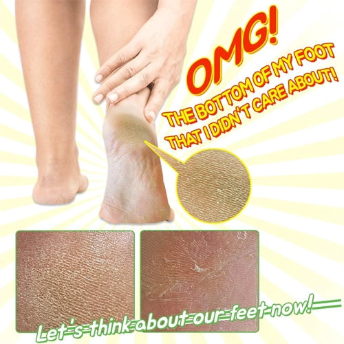 [Elizavecca] (Renew) Witch Piggy Hell Pore Turtle Foot Pack (1 pair)