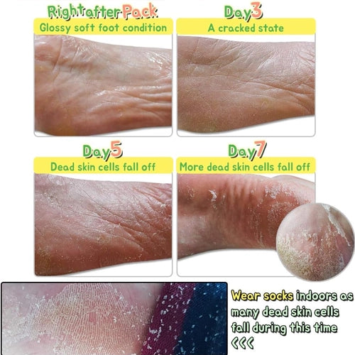 [Elizavecca] (Renew) Witch Piggy Hell Pore Turtle Foot Pack (1 pair)