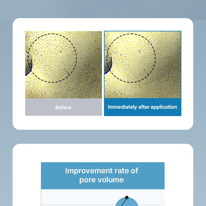 [NEEDLY] Daily Toner Pad (80 pads)