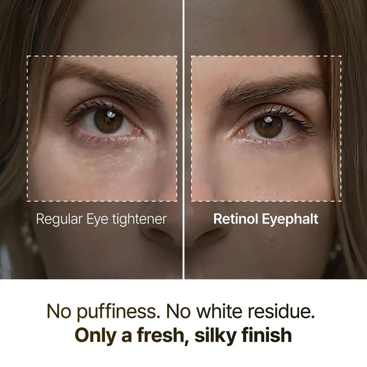 [Dr.Melaxin] Eyephalt Retinol Eyebag Cream 10g