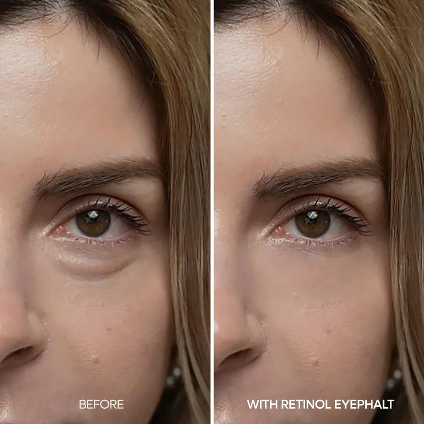 [Dr.Melaxin] Eyephalt Retinol Eyebag Cream 10g