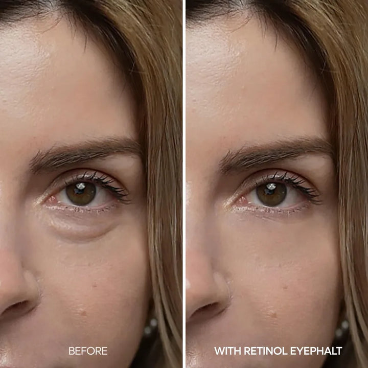 [Dr.Melaxin] Eyephalt Retinol Eyebag Cream 10g