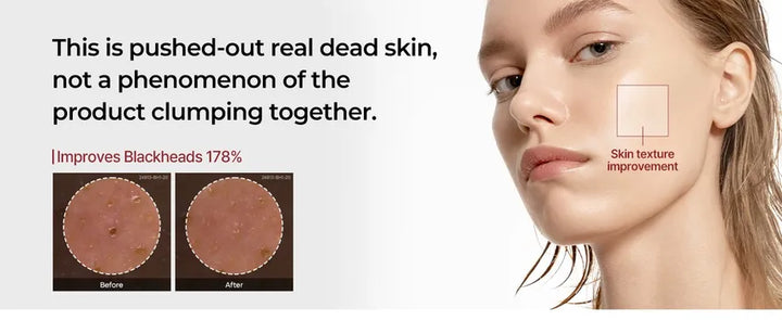 [Dr.Melaxin] Peel Shot Exfoliating Black Rice Ampoule