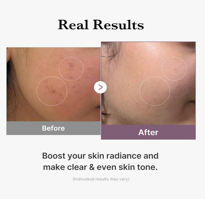 [Medicube] AGE-R Glutathione Glow Toner 140ml