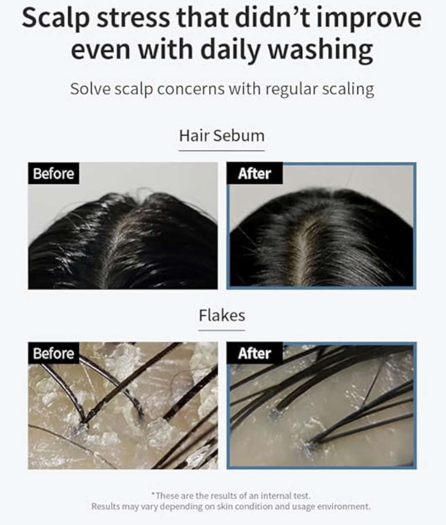 GROWUS Sea Salt Therapy Scalp Scaler 250g