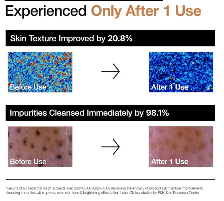 [ANUA] RICE ENZYME BRIGHTENING CLEANSING POWDER 40g