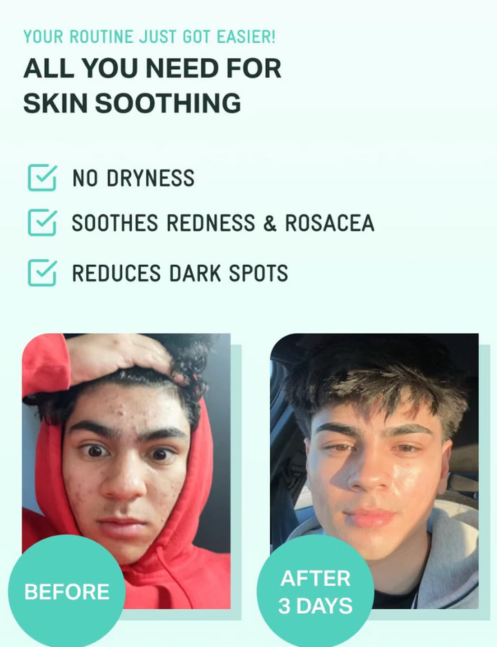 BRING GREEN ZINC TECA Serum