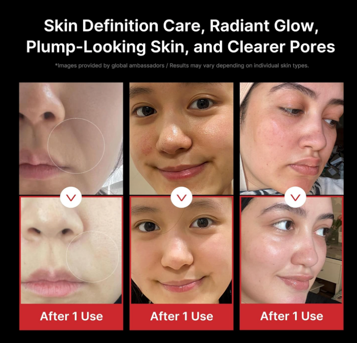 [Medicube] AGE-R Booster PRO ✨ Glass Skin Device + FREE Collagen Jelly Cream 50ml 🎁 (20% OFF)