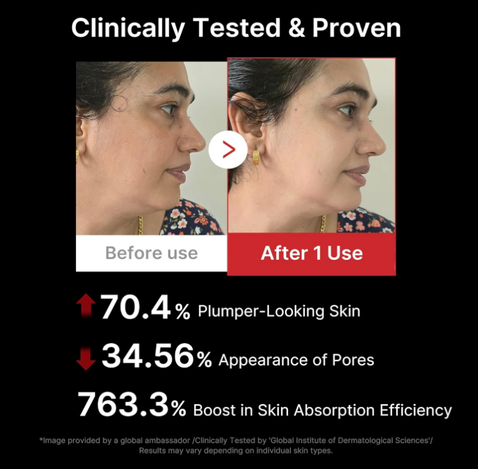 [Medicube] AGE-R Booster PRO ✨ Glass Skin Device + FREE Collagen Jelly Cream 50ml 🎁 (20% OFF)