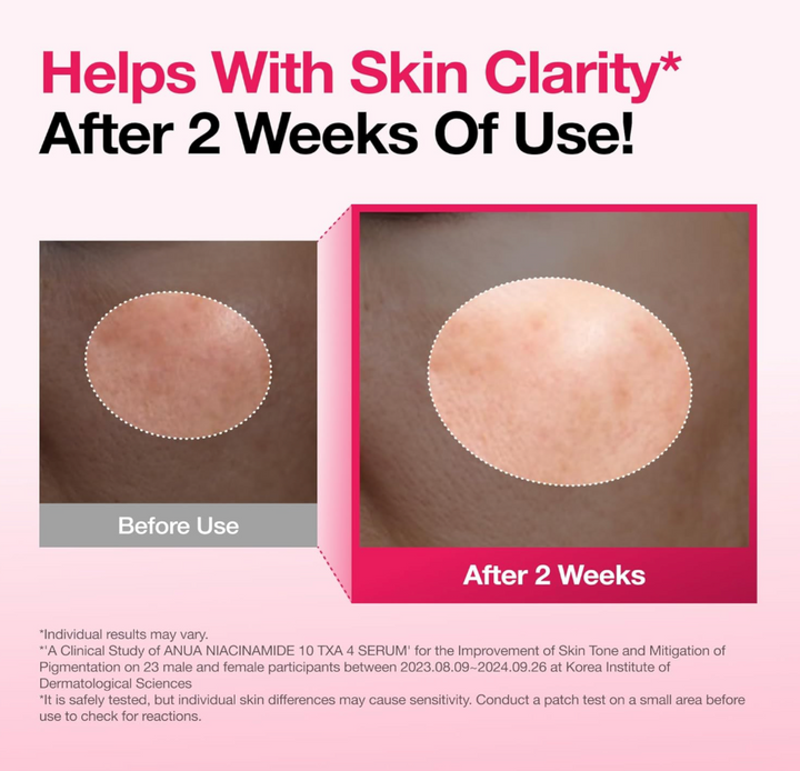 [Anua] *Renew* Niacinamide 10% + TXA 4% Dark Spot Correcting Serum 30mL