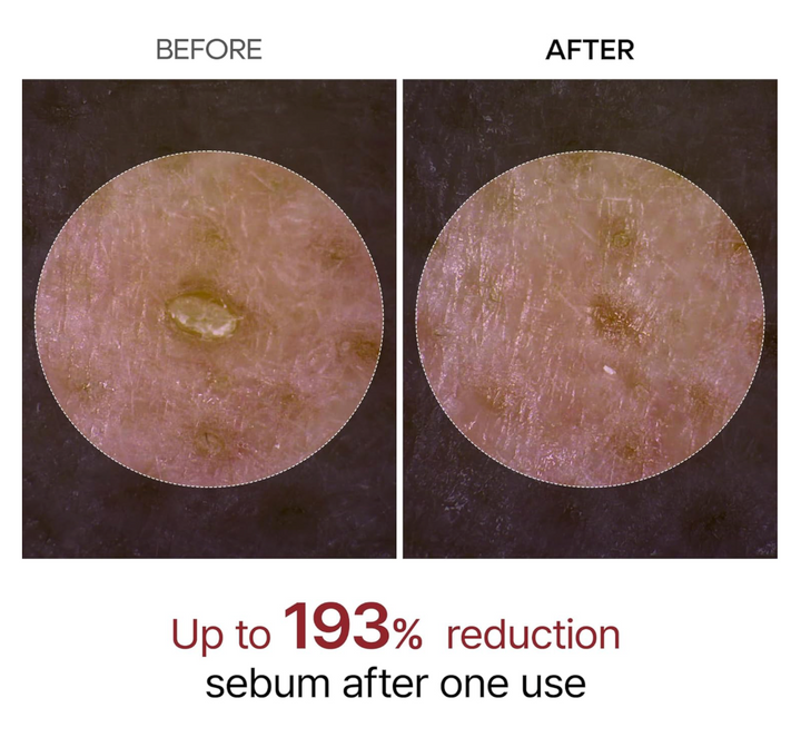 [Dr. Melaxin] Peel Shot Exfoliant Rice Ampoule
