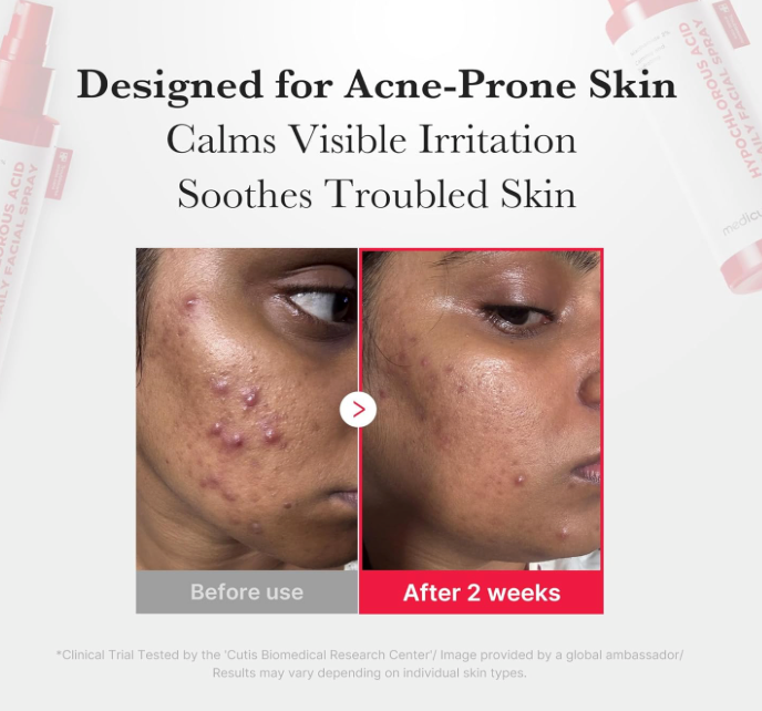 [Medicube] Hypochlorous Acid Daily Facial Spray