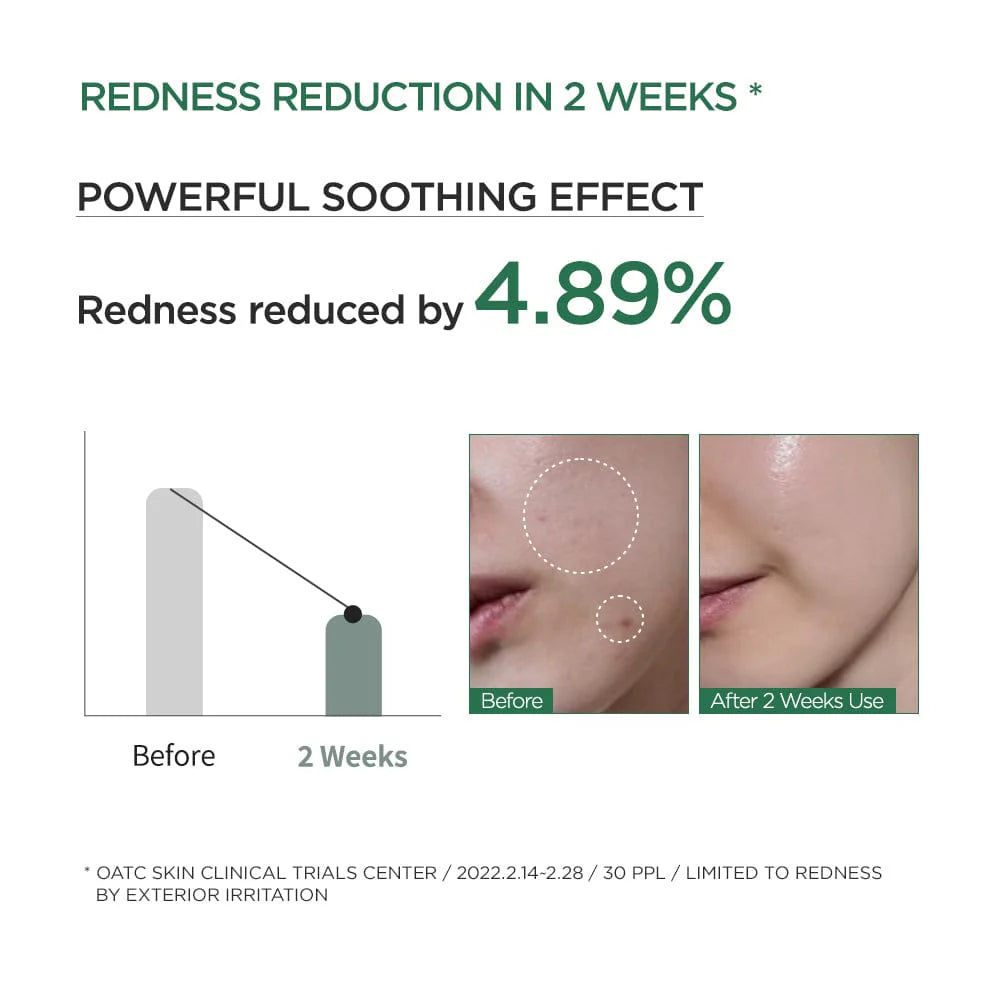 [Anua] Heartleaf 80% Ampoule 30ml