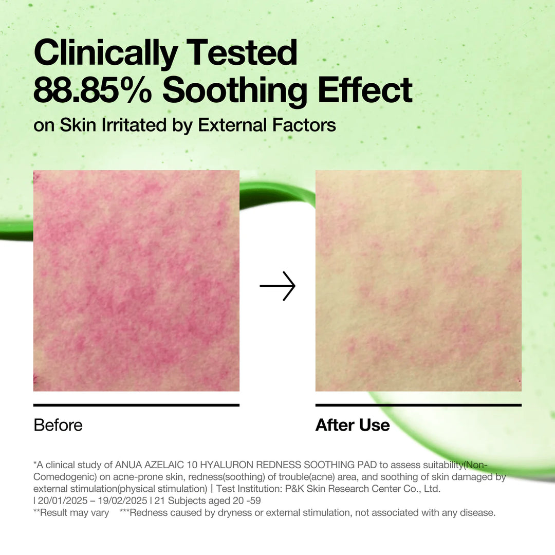 [Anua] Azelaic 10 Hyaluron Redness Soothing Pad 230ml (90ea)