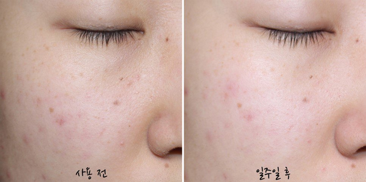 [Dr. Jart+] Cicapair Calming Mask 5ea