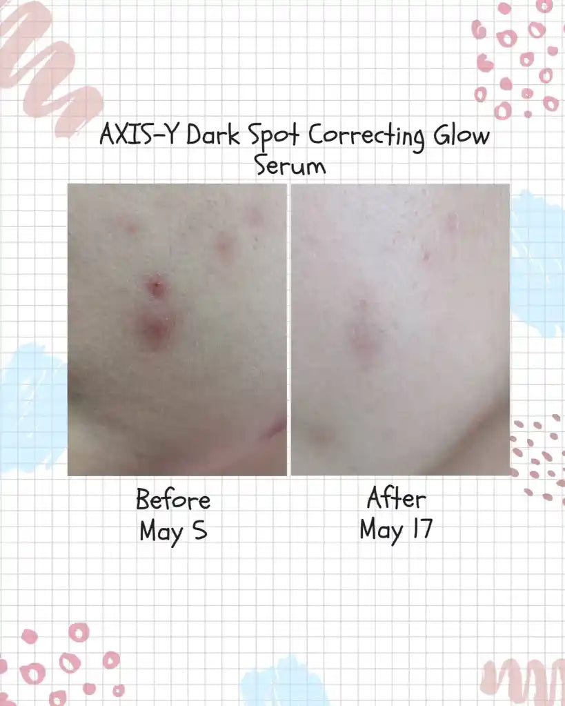 AXIS-Y Dark Spot Correcting Glow Serum 50ml – W Cosmetics
